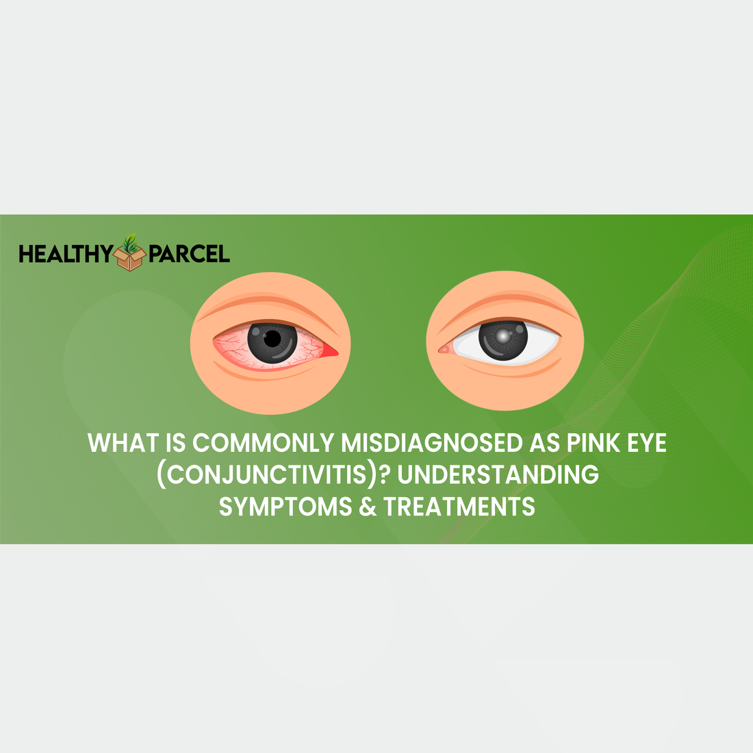What is Commonly Misdiagnosed as Pink Eye