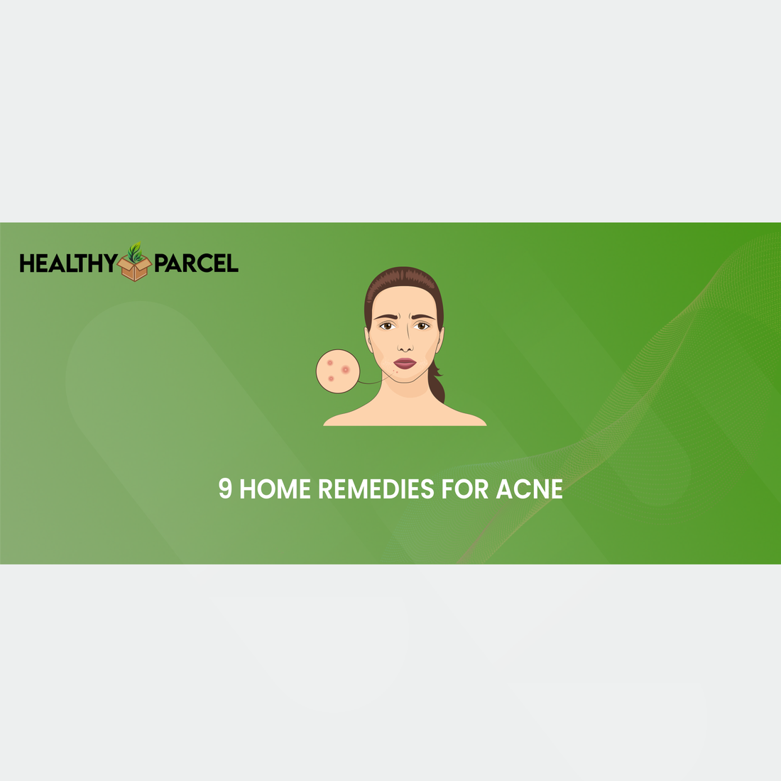 9 Home Remedies For Acne