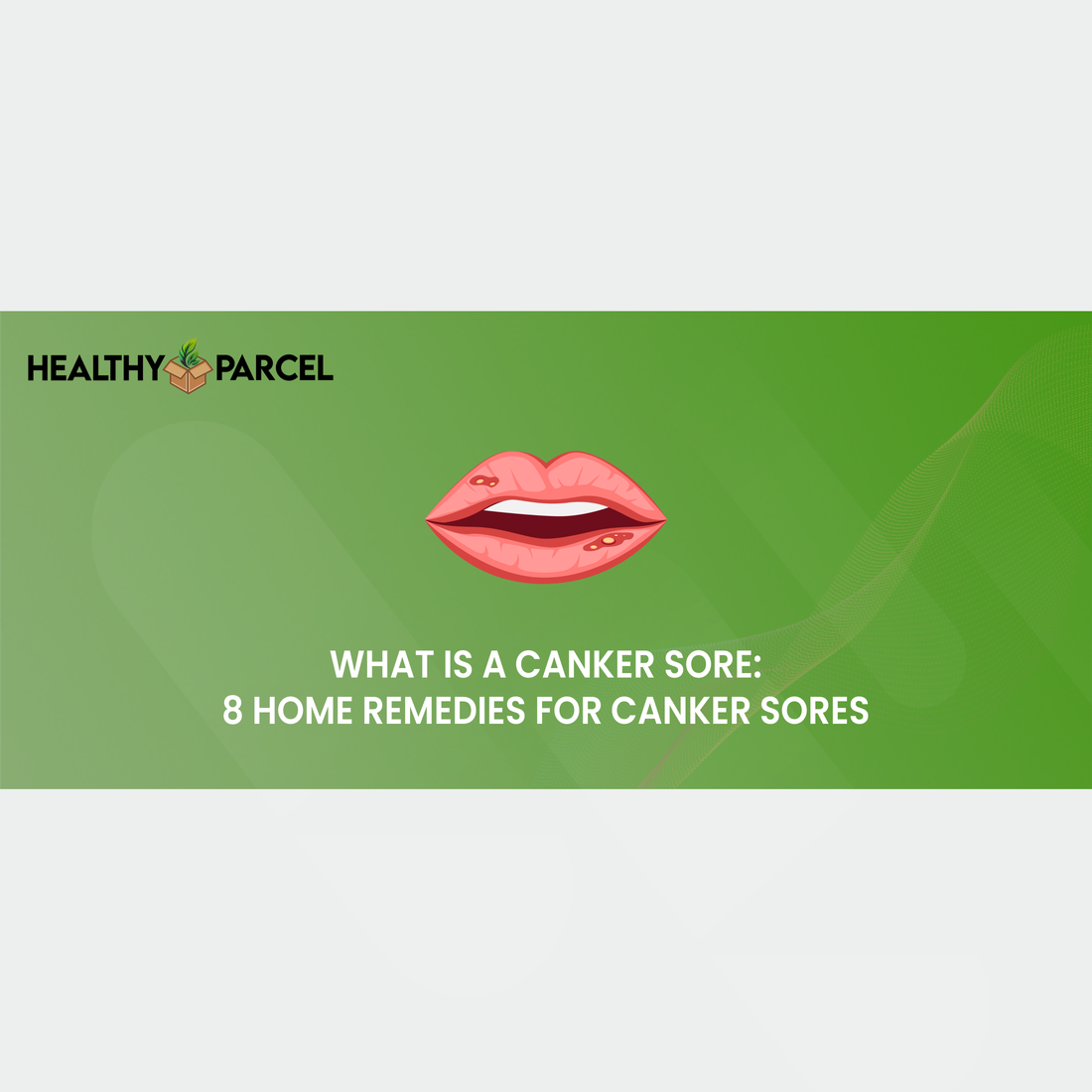 What Is a Canker Sore: 8 Home Remedies for Canker Sores